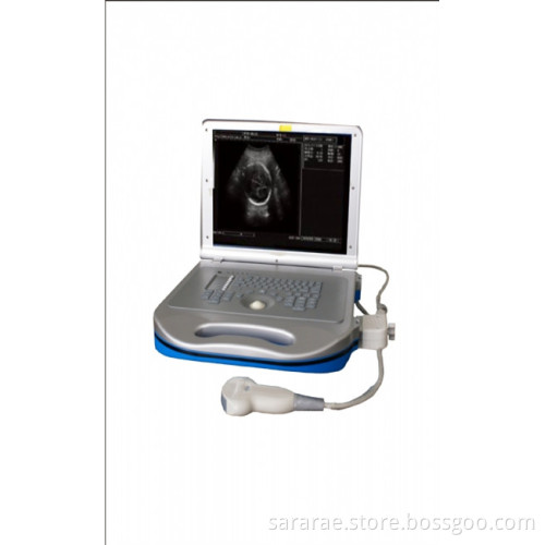 Portable Ultrasound Scanner